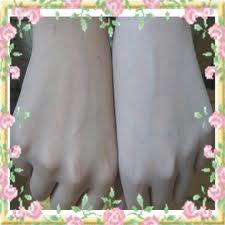 ลอกผิวขาว ลอกผิวขาว